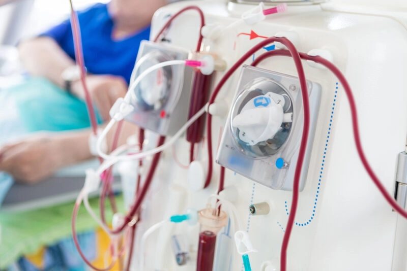medical dialysis innovation